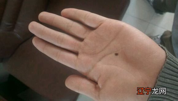 掌心痣代表什么含义
