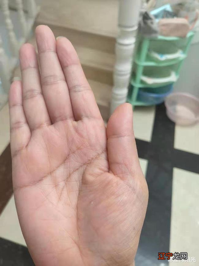 掌心痣代表什么含义
