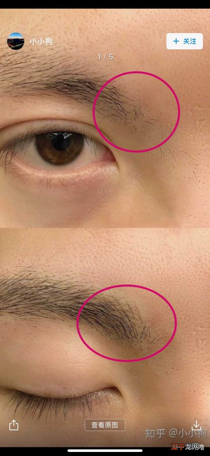 眉毛稀少_男生眉毛稀少怎么办_小孩眉毛稀少怎么办