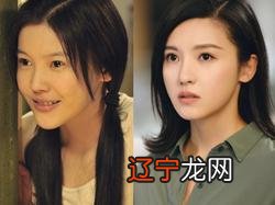 杨子姗竟然瘦出了法令纹 这个显老问题怎么破?
