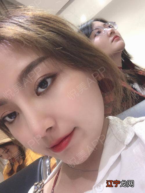 7种鼻型分类图:鼻子整形图片前后对比