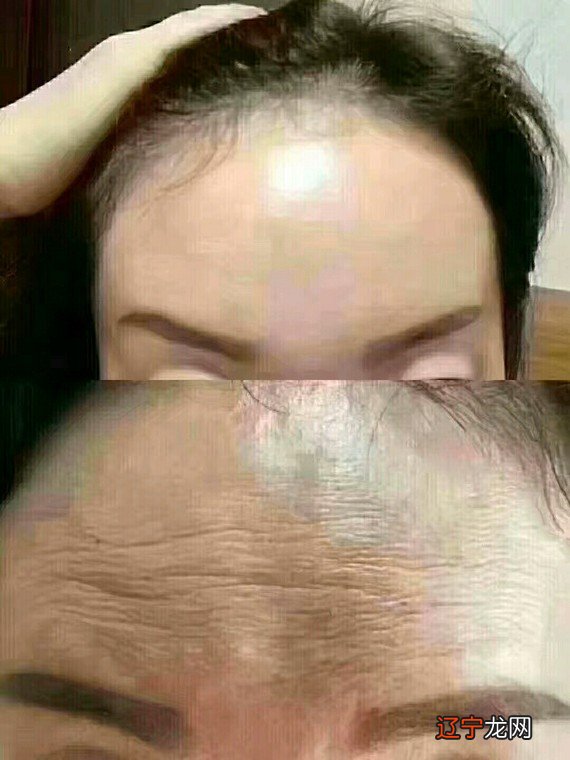 去鱼尾纹的最好土方法 鱼尾纹除皱方法