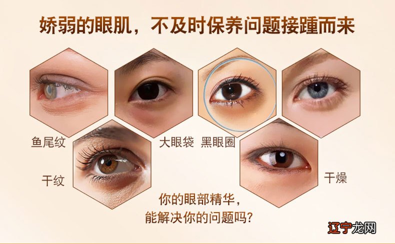 怎样减少眼角鱼尾纹