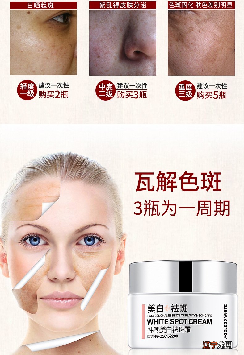 脸上长斑怎么调理,女人如何预防长色斑