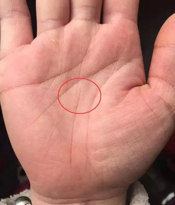 掌纹真的“掌握”人的命运吗