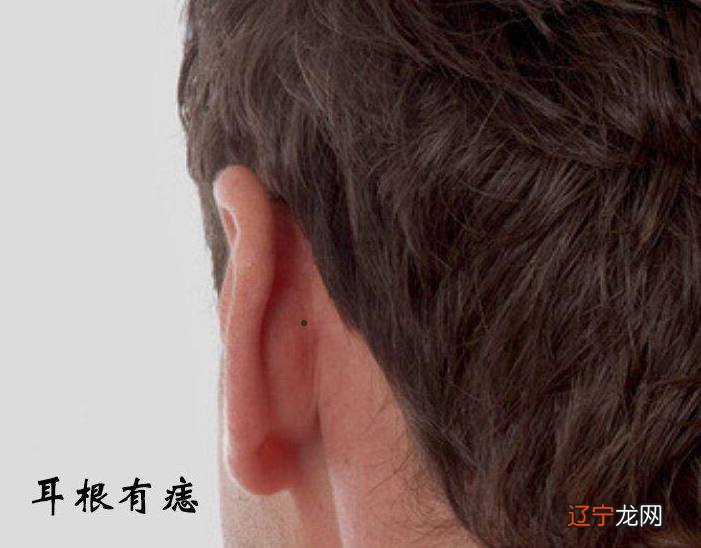 男人面相痣算命图解面相学分析男性人中有痣的人