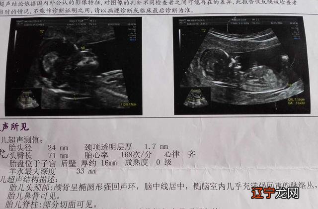 怀上男孩的母体症状,这几点才真正准确