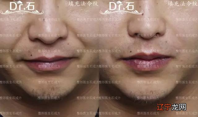 面相算命中,可以从你的法令纹面相看性格