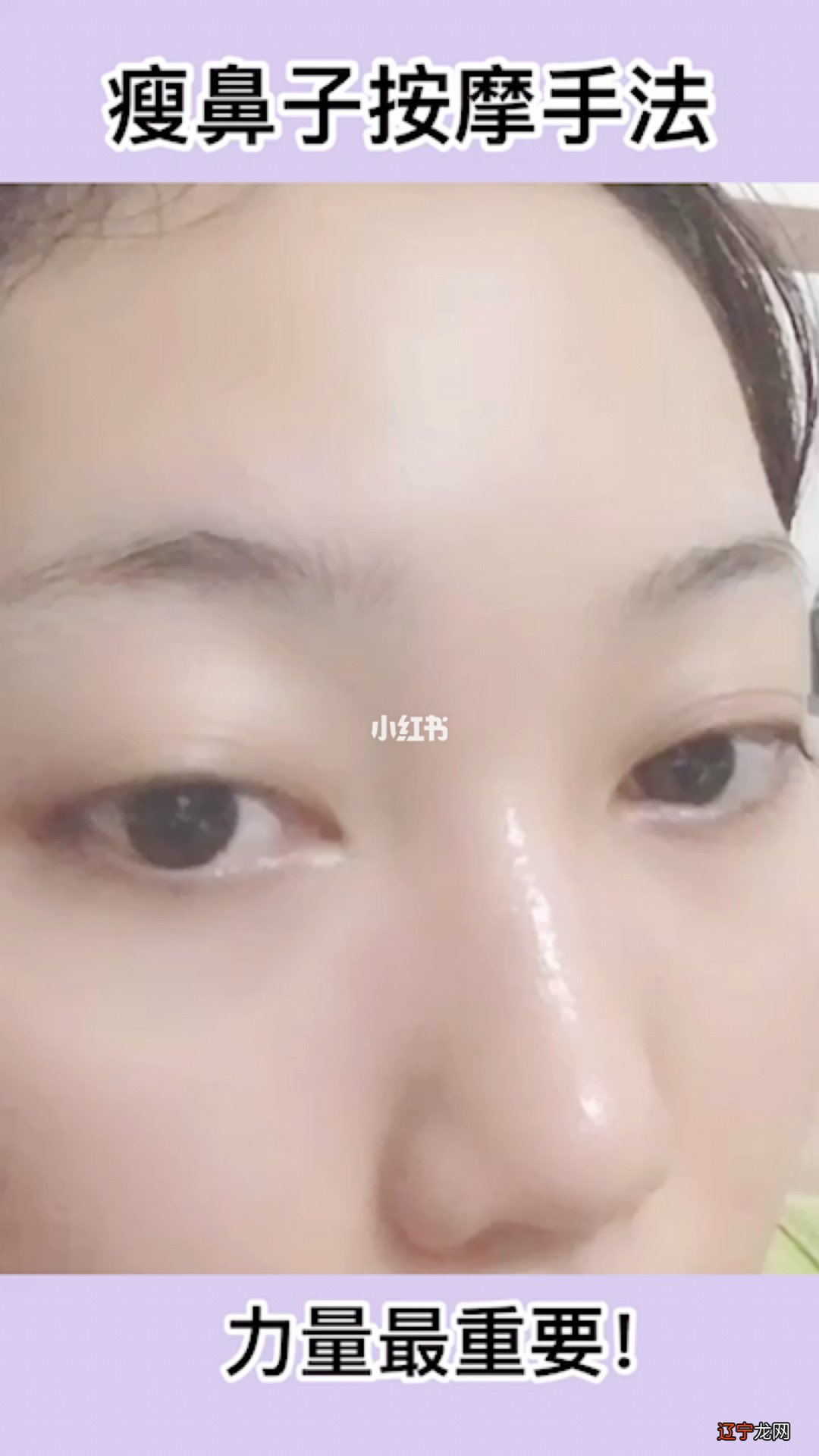 我是如何改善鼻翼肥大的