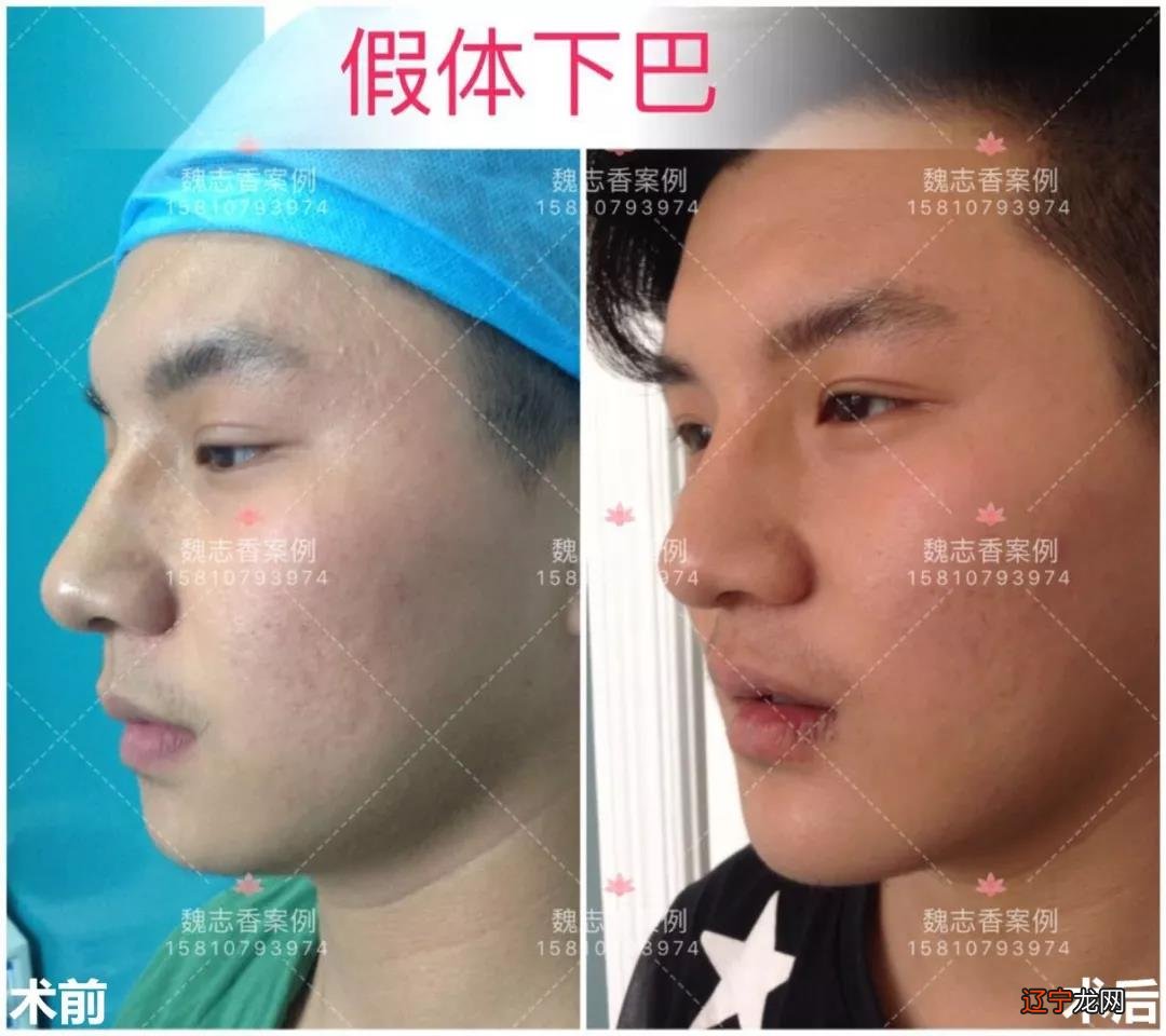 由下巴形状看你下半生福气