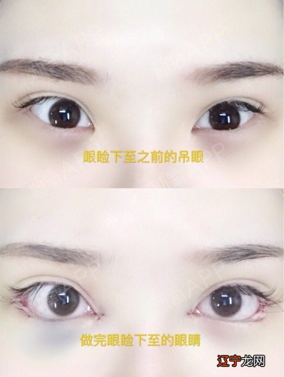 什么是丹凤眼好看吗-桃花眼和丹凤眼图片