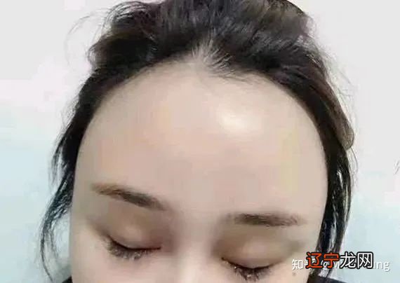 你的额头决定你的气质！