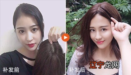 女人发际线高有什么说法?已解答