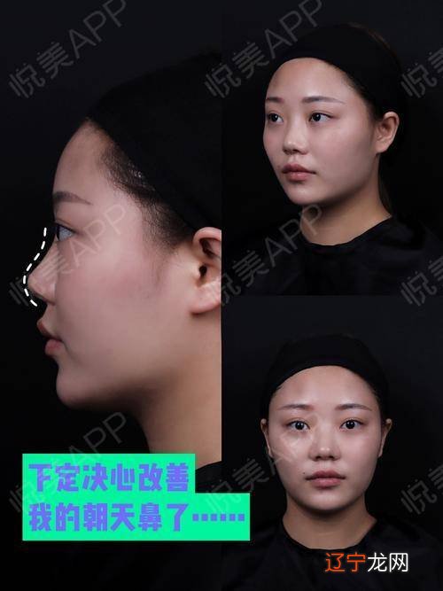 男人鼻头塌陷面相有什么说法?男人鼻梁低面相里好吗