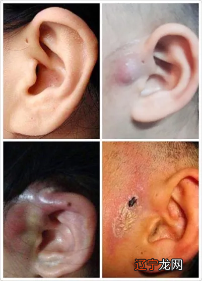 什么叫招风耳_招风耳面相