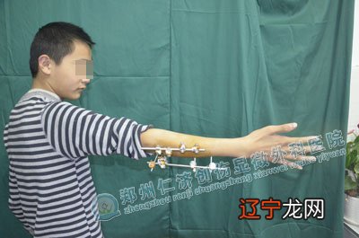 招风耳是聪明、福气的象征?耳朵有这些“特点”,父母要注意了