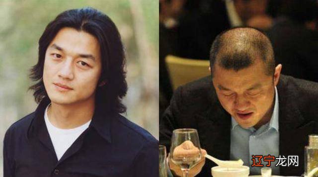 额头低窄的女人喜欢大叔型男人吗 发际线太低额头窄小