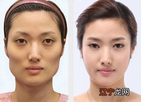 颧骨高克夫_女人颧骨高真的克夫吗?_女人颧骨高真的克夫吗