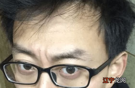 眉毛稀少的面相解析