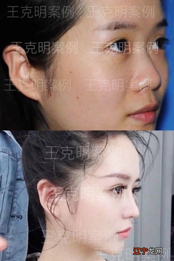 site12ky.com 手相学大全图解_相学大全图解 五官_相学大全图解 五官额头高好吗