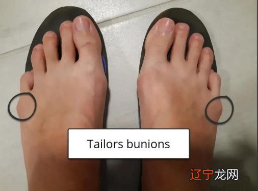 脚背长痣富贵图解大全，看完你就知道了！