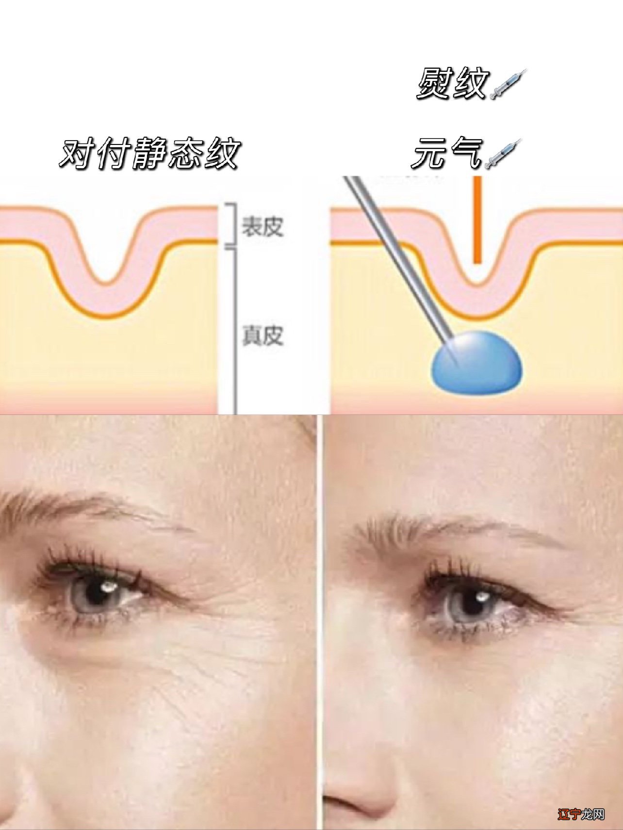 男人笑起来眼角有皱纹什么性格