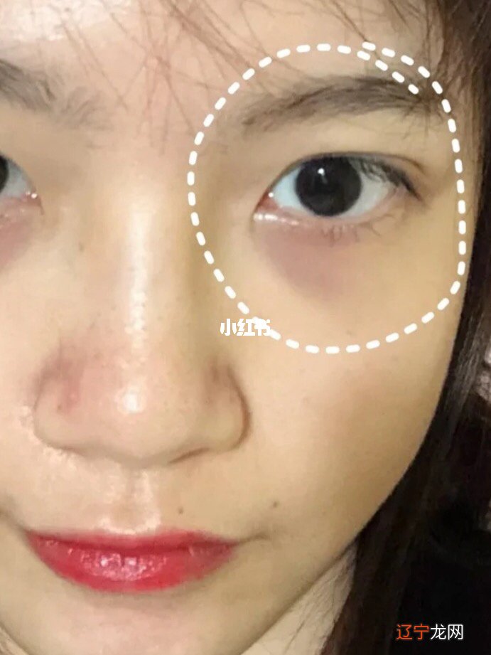 小心！20岁的你已经被鱼尾纹盯上了