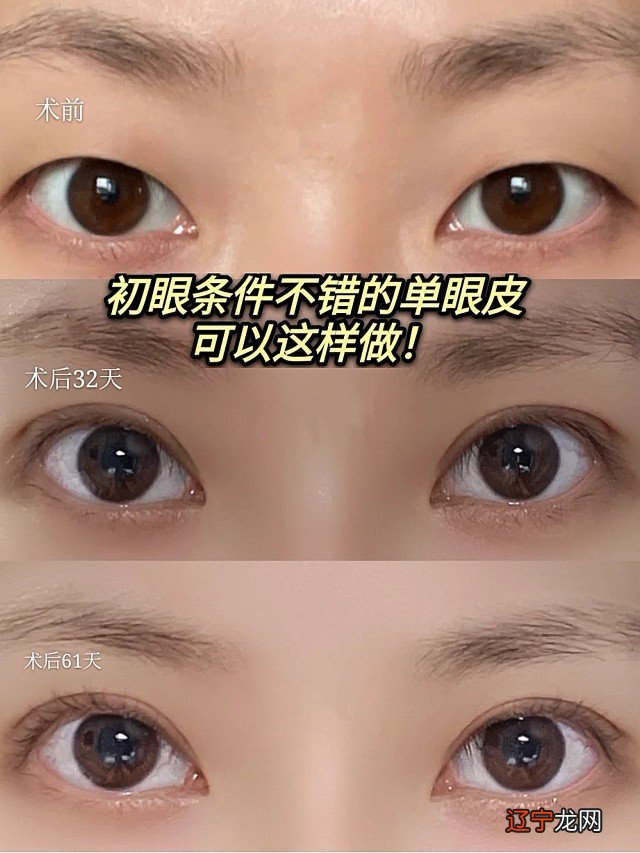 从八字日柱看2017运势_眼睛龙宫看运势_吴宗宪看眼睛看胸段子