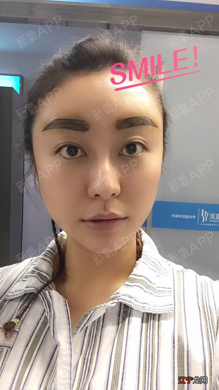 眉毛种植会有副作用现象吗