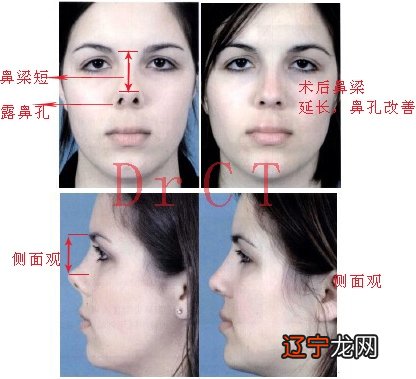 最吝啬男人面相是怎么样的?就跟着学习啦