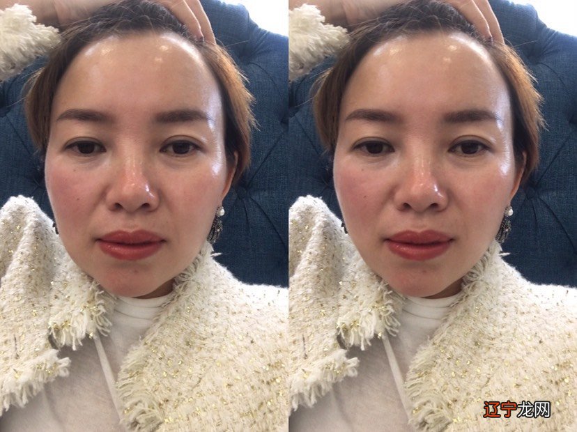 面部做什么动作可以消除法令纹