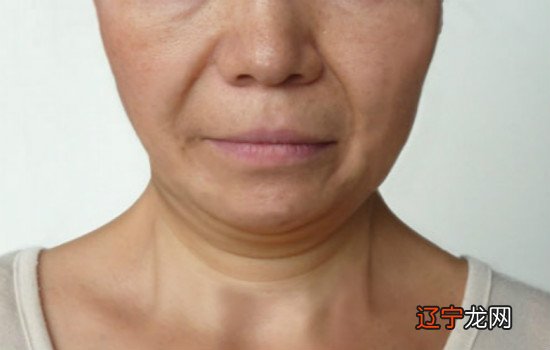 面部做什么动作可以消除法令纹