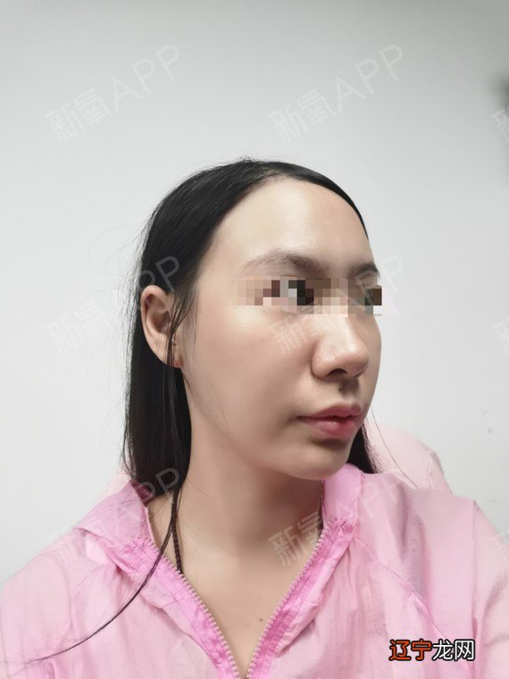 面部做什么动作可以消除法令纹