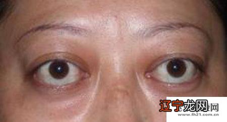 组图 眼睛突的男人面相性格男人眼睛面相解析