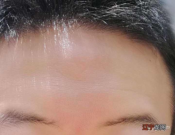 胎记的位置与运势之间有些什么关系呢?五大胎记影响运势