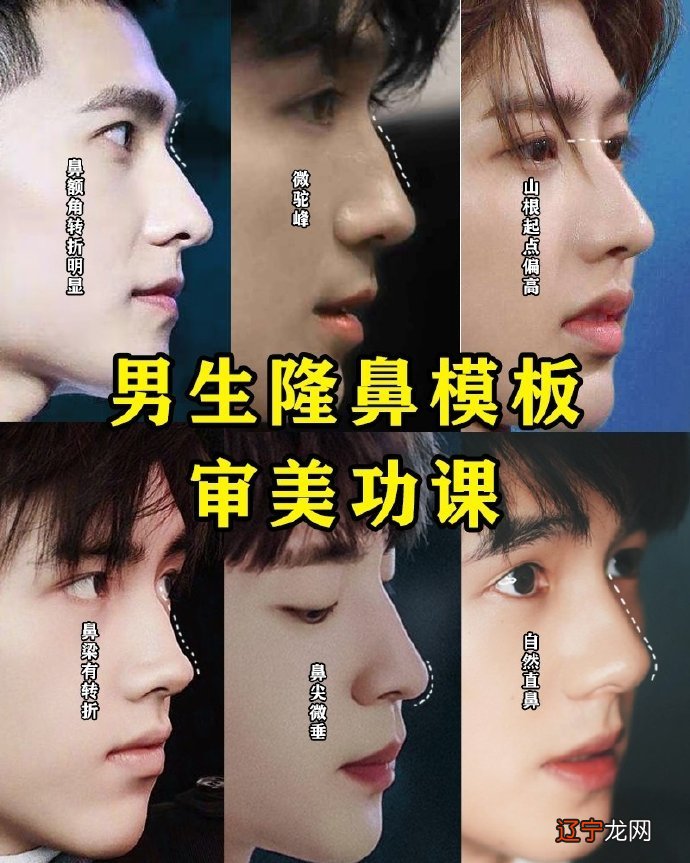 组图 驼峰鼻男人的命运驼峰鼻多一种先天性畸形