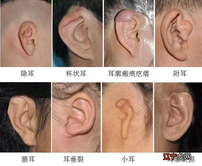 山地车碟刹和v刹区别_相学痣相刹痣_柔刹王跟刹车王区别