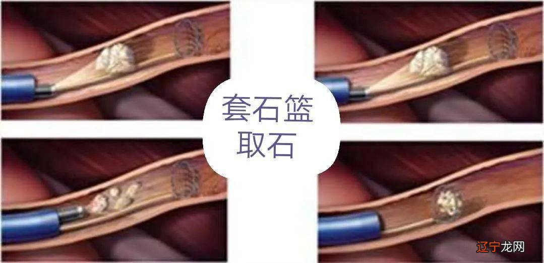 组图 图片发自简书简书搬运嫁梦寄杖寄杖土行射覆射覆