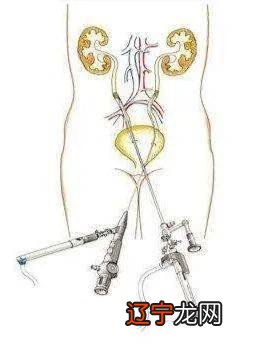 组图 图片发自简书简书搬运嫁梦寄杖寄杖土行射覆射覆