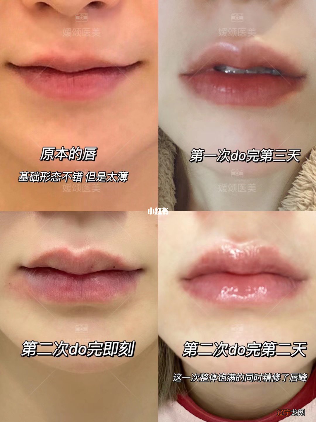 唇相面相看今生的命运运势，唇薄而饱满