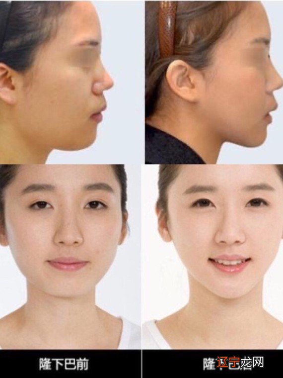 下巴看相怎么看？奴仆宫位于下巴