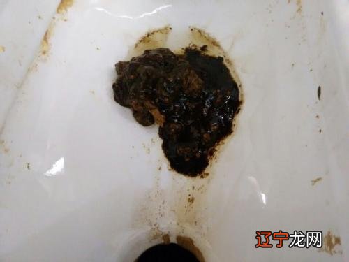 风水堂：梦见大便有血的相关解释解析