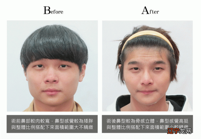 风水堂:额头光亮无伤疤的男人富贵面相