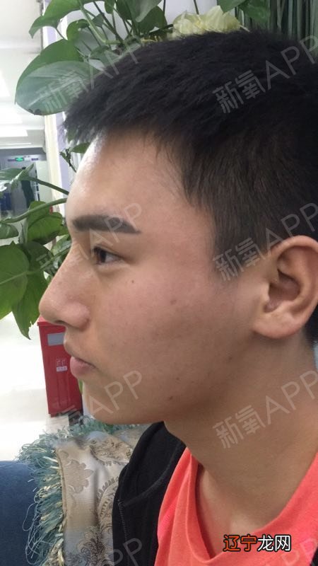 风水堂:额头光亮无伤疤的男人富贵面相