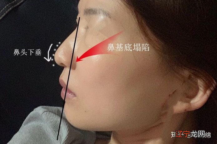 【李向东】怎么看鼻翼面相财运解析,看完你就知道了