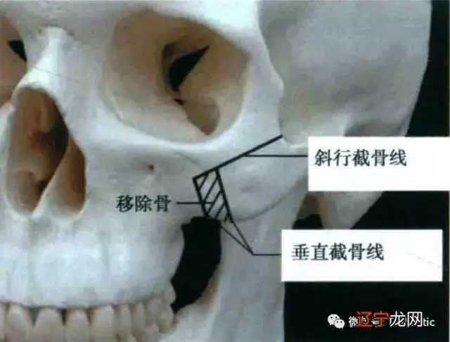 精气神和骨骼，是观人的第一要决，你知道吗？