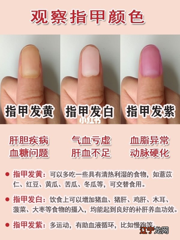 易安居周易:指甲不但可以表现其人的健康状态!