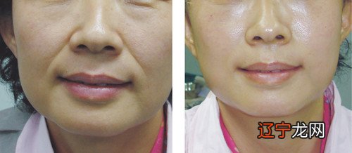 从鼻翼两旁开始的法令纹面相，你知道吗？