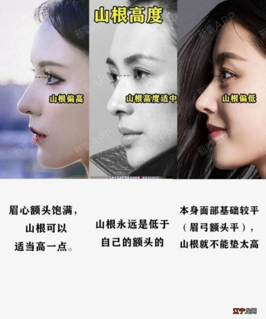 【李向东】山根断的人六亲无靠,你知道吗?