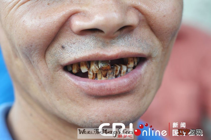 梦见牙掉了,原来的坚固的信念可能动摇了!